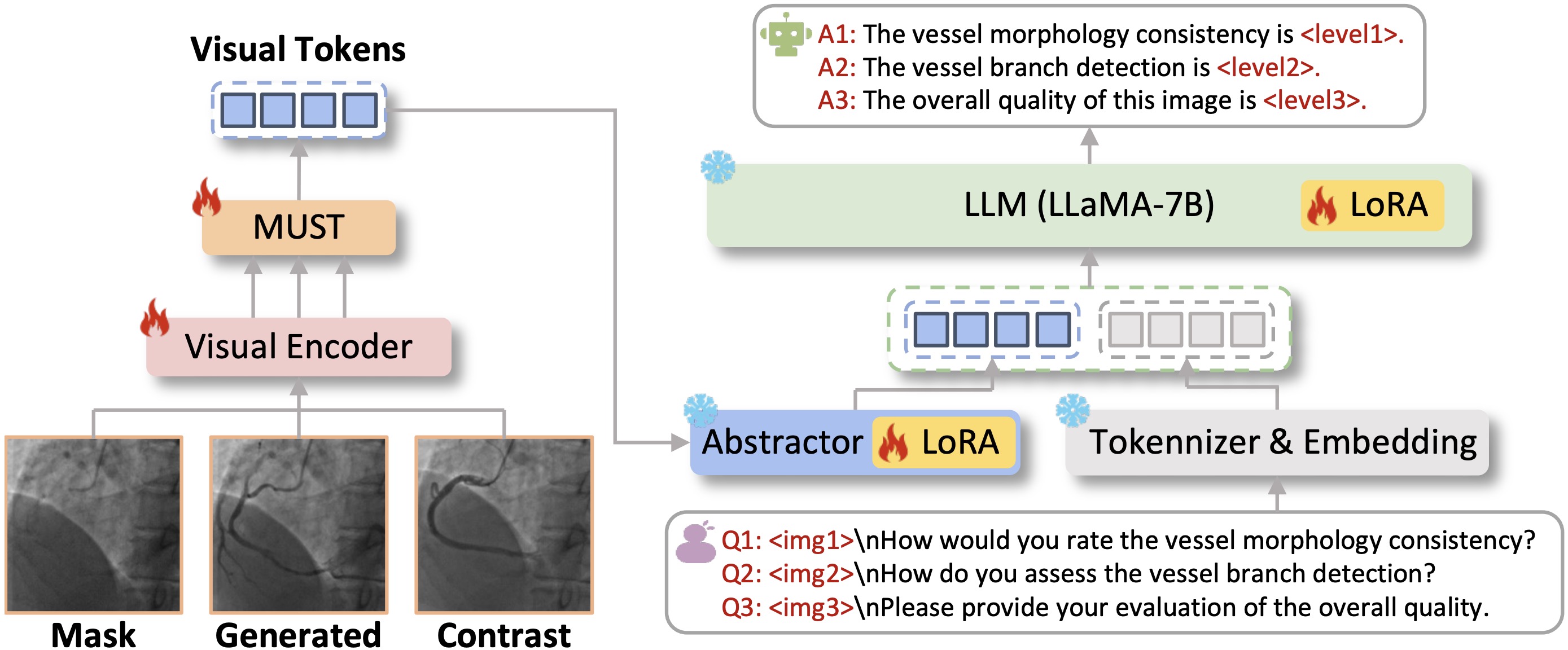 CAS-IQA: Teaching Vision-Language Models for Synthetic Angiography Quality Assessment