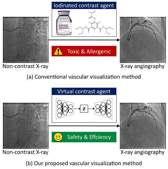 CAS-GAN for Contrast-free Angiography Synthesis